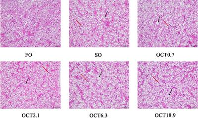 Effects of supplemental octanoate on hepatic lipid metabolism, serum biochemical indexes, antioxidant capacity and inflammation-related genes expression of large yellow croaker (Larimichthys crocea) fed with high soybean oil diet